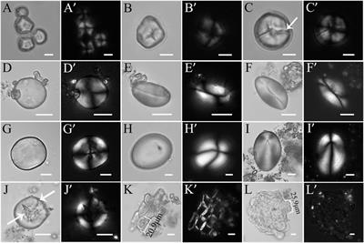 Human Diet Patterns During the Qijia Cultural Period: Integrated Evidence of Stable Isotopes and Plant Micro-remains From the Lajia Site, Northwest China